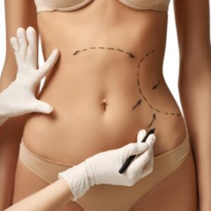 LIPO HD COM BODYTITE