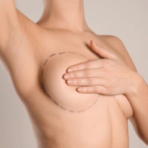 LIPO DAS MAMAS COM ENXERTO GORDURA PEITORAL