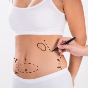LIPOESCULTURA