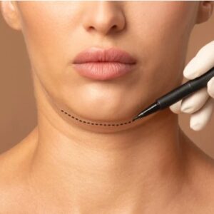 DEEP NECK PAPADA