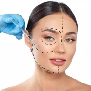 HARMONIZAÇÃO FACIAL COM PRODUTO