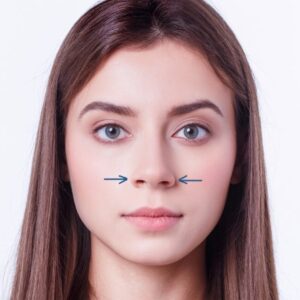 ALECTOMIA
