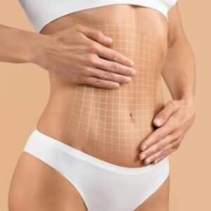 ARGOPLASMA + BODYTITE + MORPHUES BRAÇOS