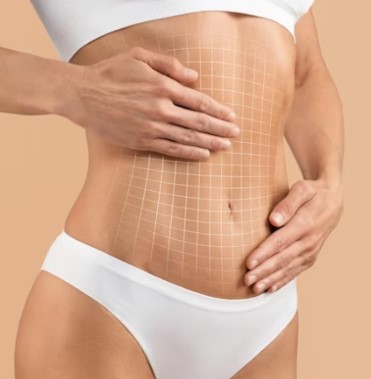 ARGOPLASMA + BODYTITE + MORPHUES BRAÇOS
