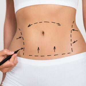 LIPO HD DORSO
