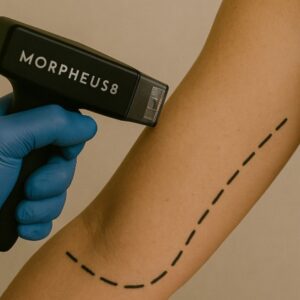 MORPHEUS BRAÇO