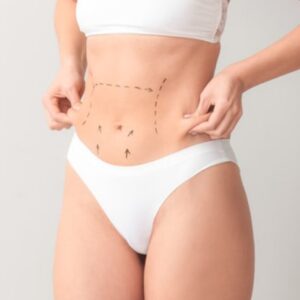 BODYTITE ABDOMEN